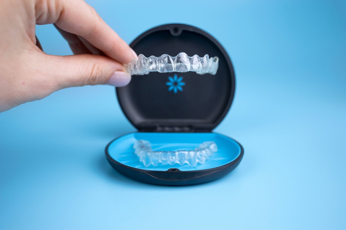 Zwei durchsichtige Zahnschienen (Invisalign Aligner) auf einem blauen Hintergrund